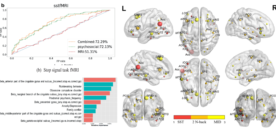 ROC curves for combined, psychosocial and MRI models, a feature-importance bar chart led by the anterior cingulate, and brain renderings of contributing regions.